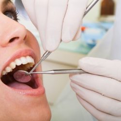 dantų plombavimas. ir odontologijos namai